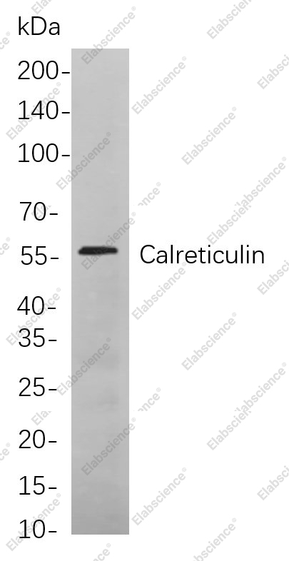Recombinant Calreticulin Monoclonal Antibody - 1