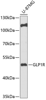 Western blot analysis of extracts of U-87MG cells using GLP1R Polyclonal Antibody at 1:1000 dilution.