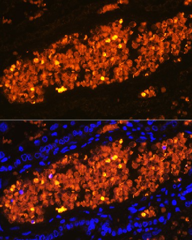 Immunofluorescence analysis of Rat placenta using HBA2 Polyclonal antibody at dilution of 1:100 (40x lens). Blue: DAPI for nuclear staining.