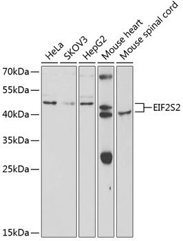 Western blot analysis of extracts of various cell lines using EIF2S2 Polyclonal Antibody at 1:1000 dilution.