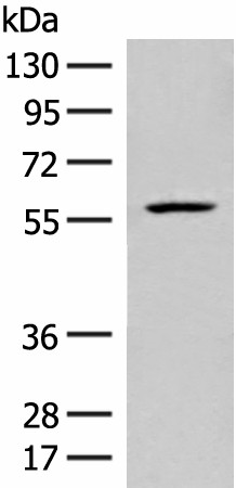 Western blot analysis of Mouse liver tissue lysate  using FKTN Polyclonal Antibody at dilution of 1:450