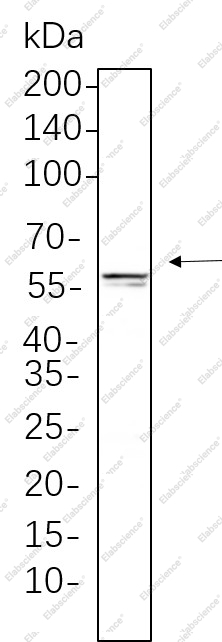 Recombinant E2F-1 Monoclonal Antibody - 1