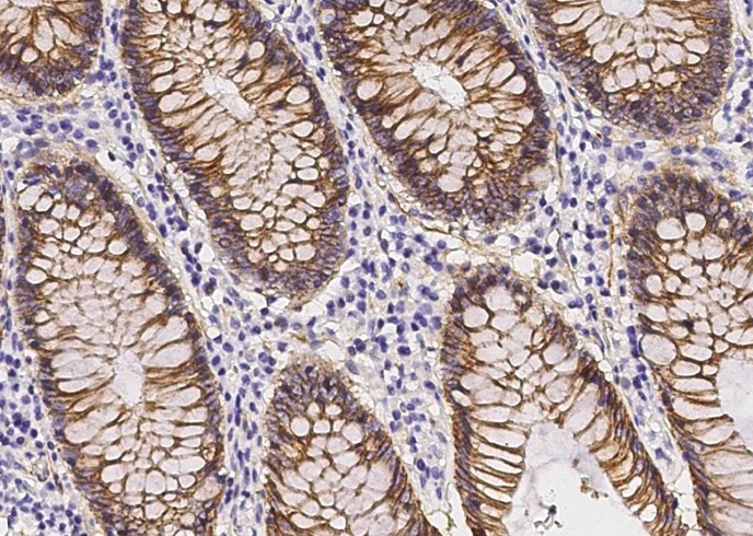 Recombinant beta-Catenin/CTNNB1 Monoclonal Antibody - small - 3