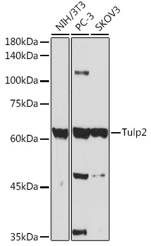 Western blot analysis of extracts of various cell lines using Tulp2 Polyclonal Antibody at 1:1000 dilution.