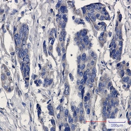 Recombinant Microsomal Glutathione S-transferase 1 Monoclonal Antibody - 3