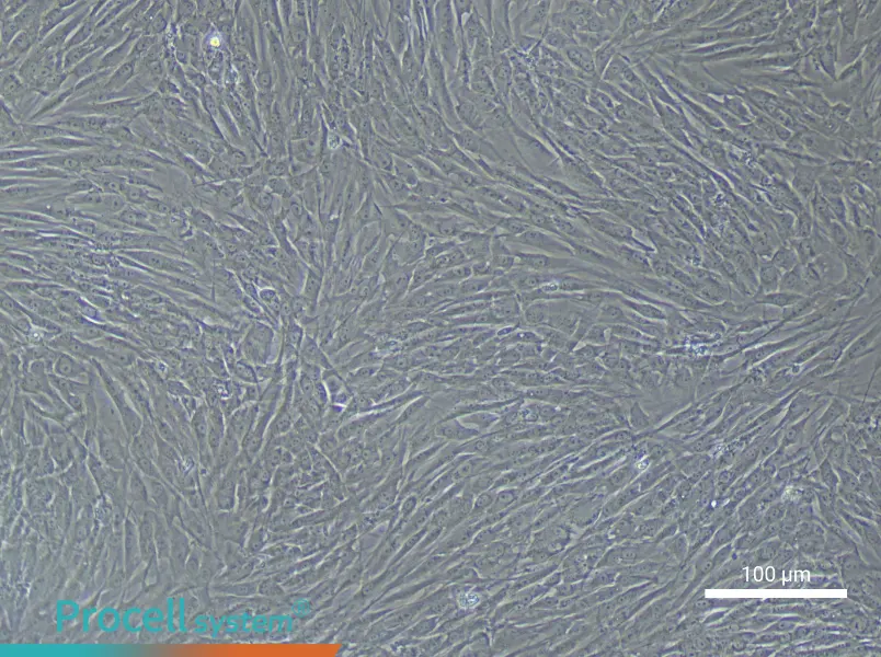 Human Pulmonary Artery Smooth Muscle Cell Complete Medium - 3