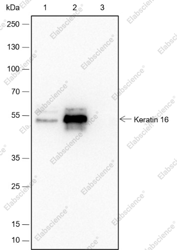 Recombinant Keratin 16 Monoclonal Antibody - 5