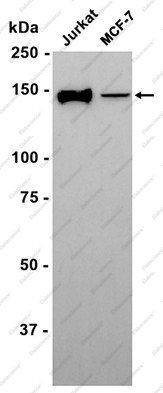 Recombinant FGFR2 Monoclonal Antibody - 1