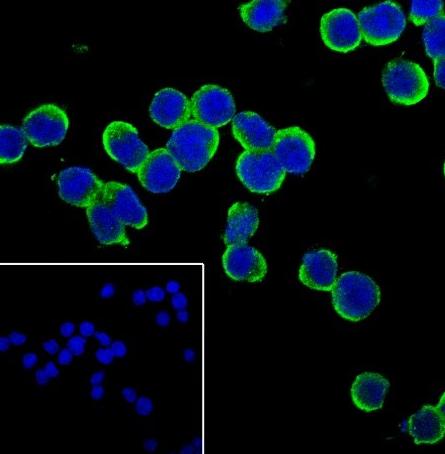 Recombinant IL-4 Monoclonal Antibody-searchlist-2