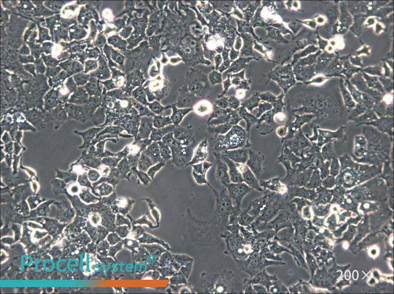 Ishikawa Cell Complete Medium - small - 4