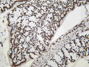 Recombinant MACROH2A1 Monoclonal Antibody - 3