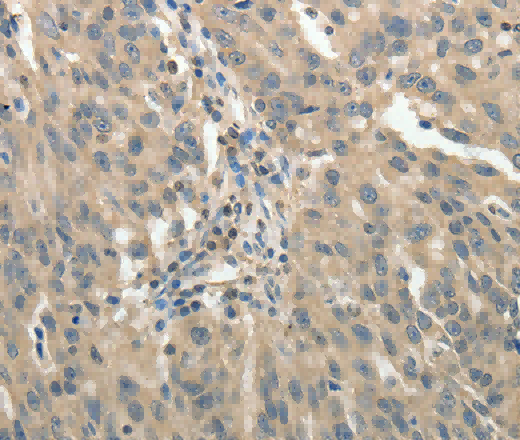 GSR Polyclonal Antibody - 3