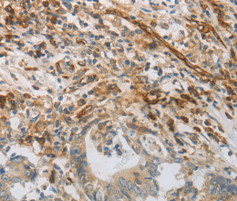 CD31 Polyclonal Antibody - 3