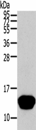 Western Blot analysis of Human normal liver tissue using THRSP Polyclonal Antibody at dilution of 1/400