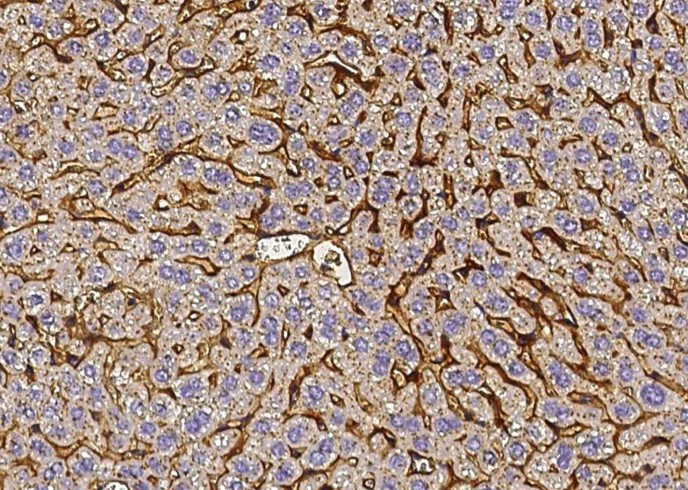 Recombinant Vitronectin/VTN Monoclonal Antibody-searchlist-1