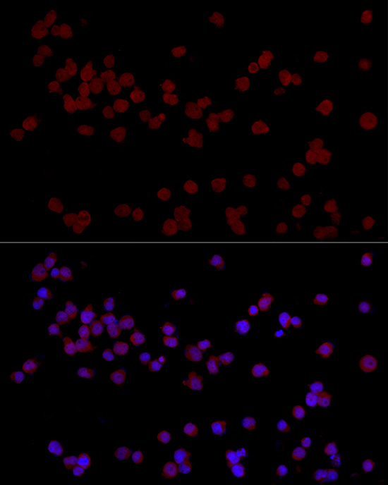 Immunofluorescence analysis of Jurkat cells using CTIP2/BCL11B Polyclonal Antibody at dilution of 1:50 (40x lens). Blue: DAPI for nuclear staining.