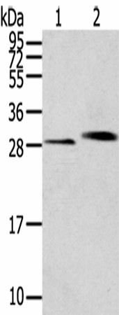 Western blot analysis of Human normal kidney tissue Human liver tissue  using CLIC4 Polyclonal Antibody at dilution of 1:200