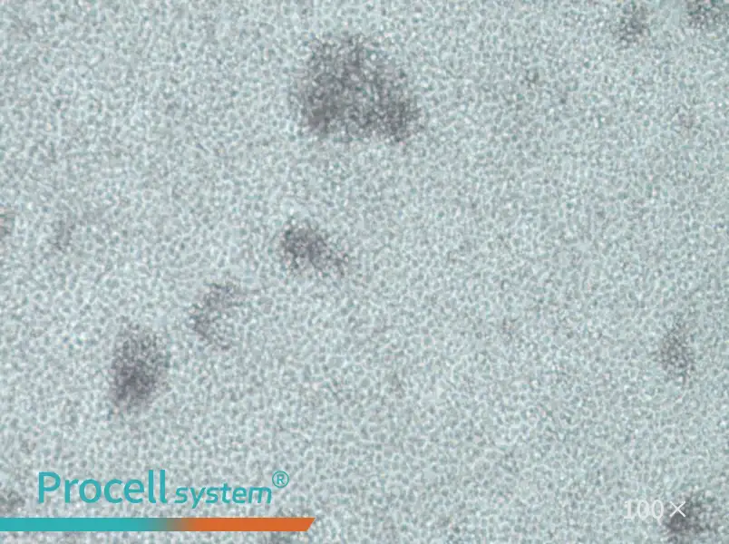 IM-9 Cell Complete Medium - 3