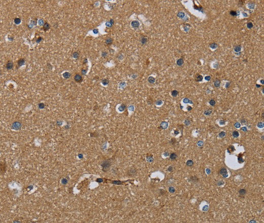 Immunohistochemistry of paraffin-embedded Human brain using PDE4A Polyclonal Antibody at dilution of 1:40