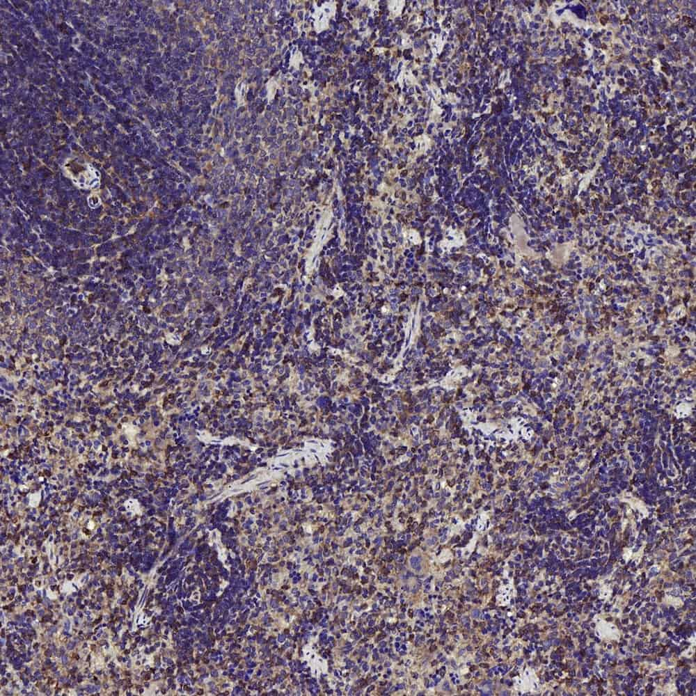 Immunohistochemistry analysis of paraffin-embedded rat spleen  using MMP9 Polyclonal Antibody at dilution of 1:300.