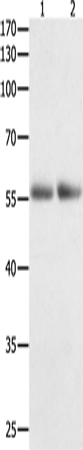 Western Blot analysis of Human colon  and  kidney cancer tissue   using HDAC1 Polyclonal Antibody at dilution of 1:400