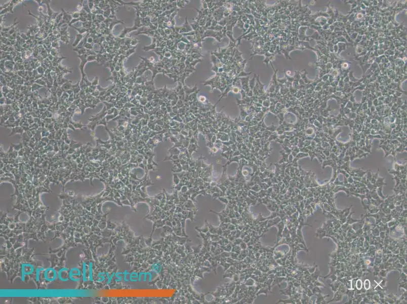 NCCIT Cell Complete MediumNCCIT Cell Complete Medium - 2