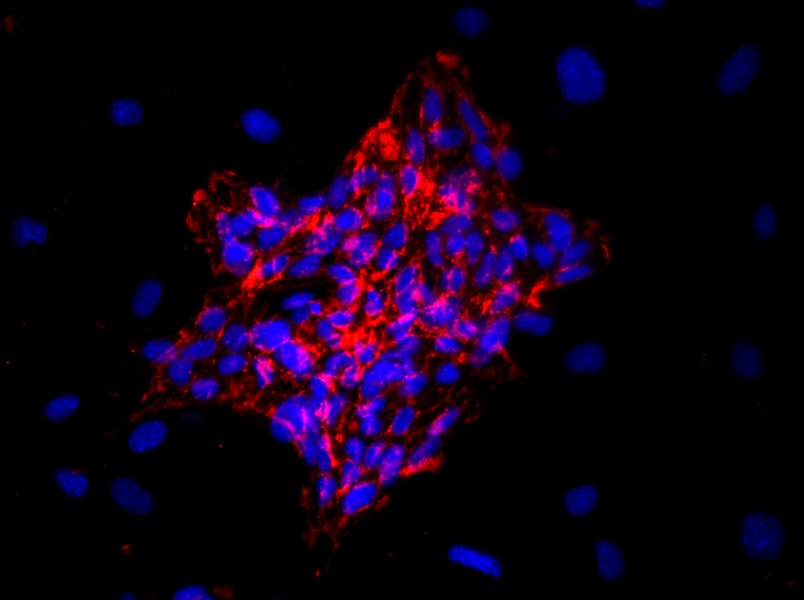 Mouse Cardiac Microvascular Endothelial Cell Complete Medium - 2