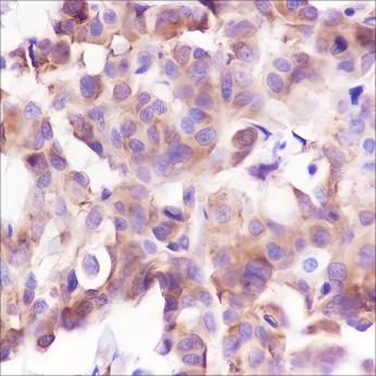 Recombinant Phospho-S6 Ribosomal Protein (Ser240, 244) Monoclonal Antibody - small - 2