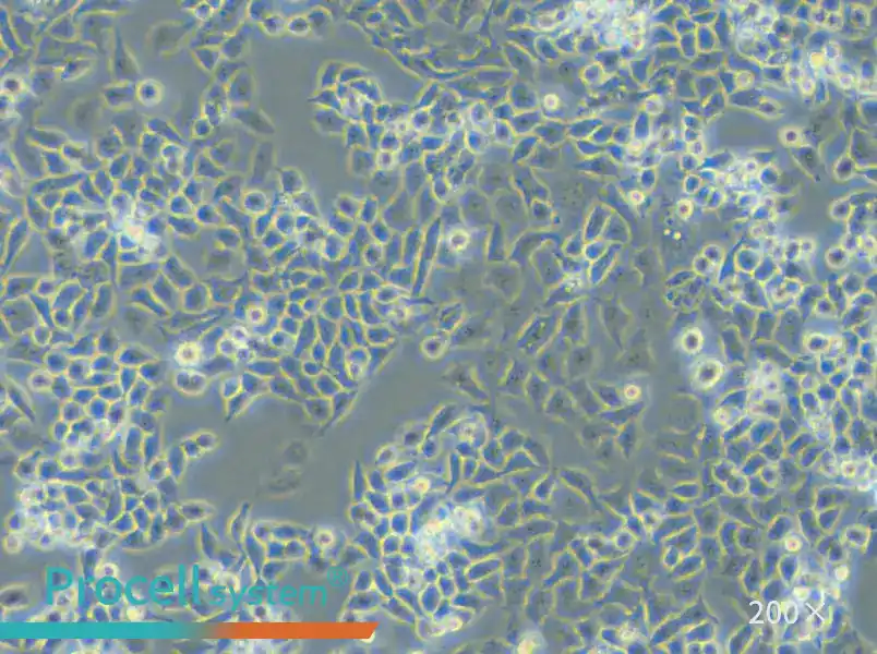 TOV-21G Cell Complete Medium - small - 4