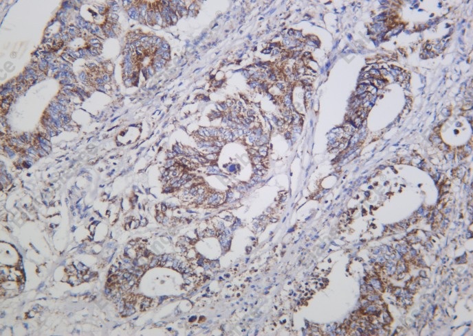 Recombinant Cleaved Caspase-3 (Asp175) Monoclonal Antibody - 2