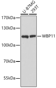 Western blot analysis of extracts of various cell lines using WBP11 Polyclonal Antibody at dilution of 1:3000.