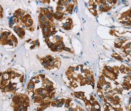 HINT2 Polyclonal Antibody - 3