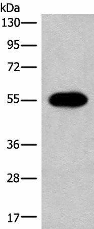 Western blot analysis of A549 cell lysate  using HAS3 Polyclonal Antibody at dilution of 1:300