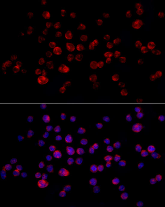 Immunofluorescence analysis of THP-1 cells using CD68 Polyclonal Antibody at dilution of 1:50 (40x lens). Blue: DAPI for nuclear staining.