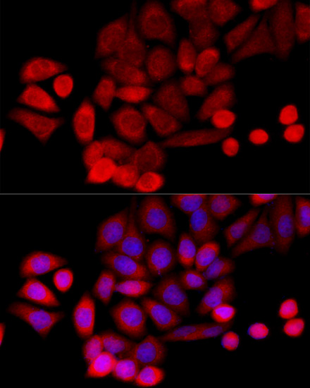 Immunofluorescence analysis of HeLa cells using PIDD Polyclonal Antibody at dilution of  1:100 (40x lens). Blue: DAPI for nuclear staining.