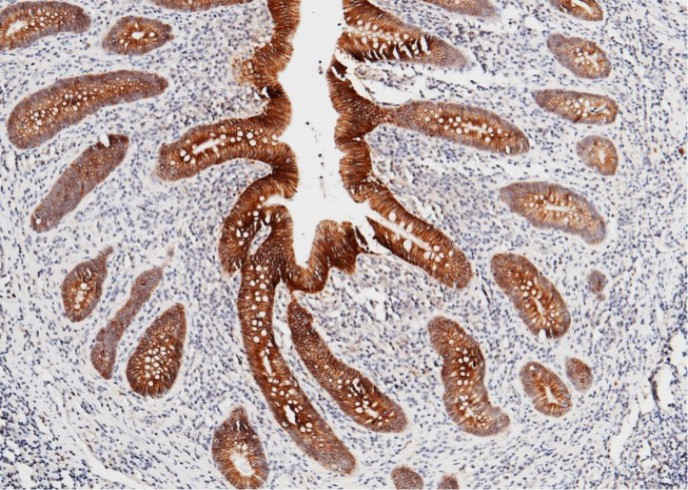 Cadherin-17/LI-cadherin/CDH17 Monoclonal Antibody - small - 2