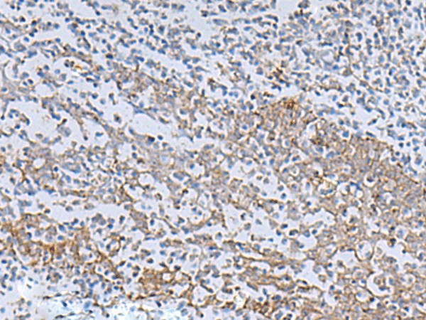 Immunohistochemistry of paraffin-embedded Human tonsil tissue  using IL22RA2 Polyclonal Antibody at dilution of 1:70(?200)