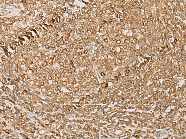 Immunohistochemistry of paraffin-embedded Human tonsil tissue  using PSMD12 Polyclonal Antibody at dilution of 1:50(?200)