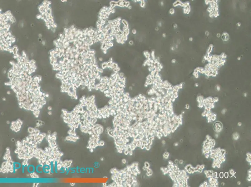 NCI-H82 [H82] Cell Complete Medium - 2