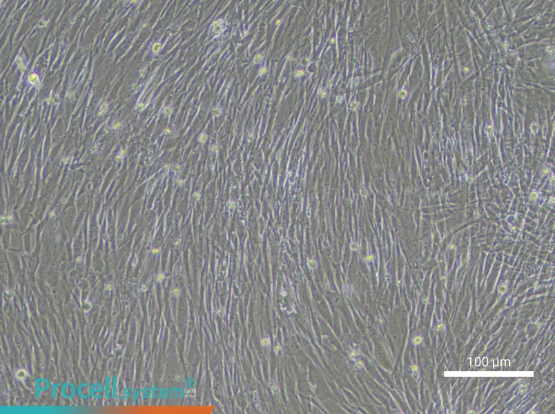 Human Pulmonary Arteriolar Smooth Muscle Cell Complete Medium - 3