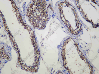 Recombinant ULA1 Monoclonal Antibody - 2