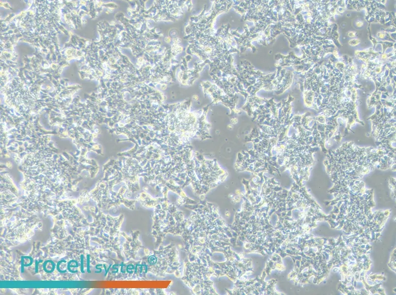 LS 174T [LS174T] Cell Complete Medium - 1