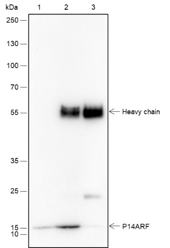 Recombinant CDKN2A/p14ARF Monoclonal Antibody - small - 4