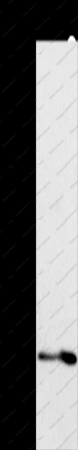 ST2 Polyclonal Antibody - 1
