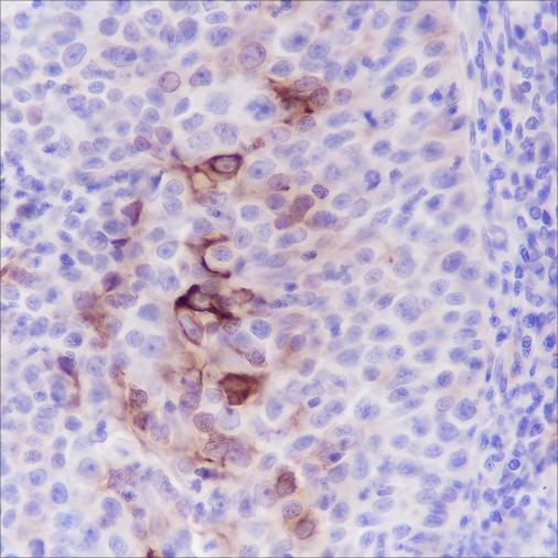Recombinant MUC4 Monoclonal Antibody - small - 3
