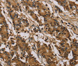 PSMC2 Polyclonal Antibody - 3