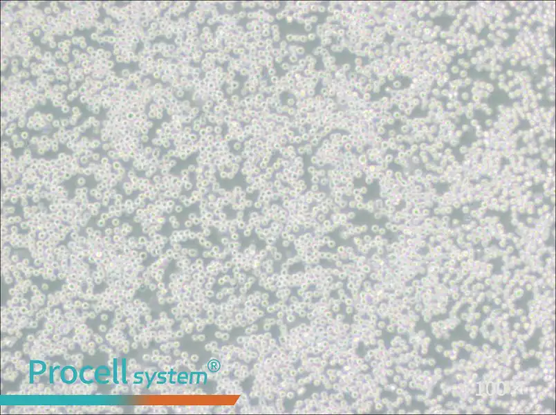 SU-DHL-4 Cell Complete Medium - 1