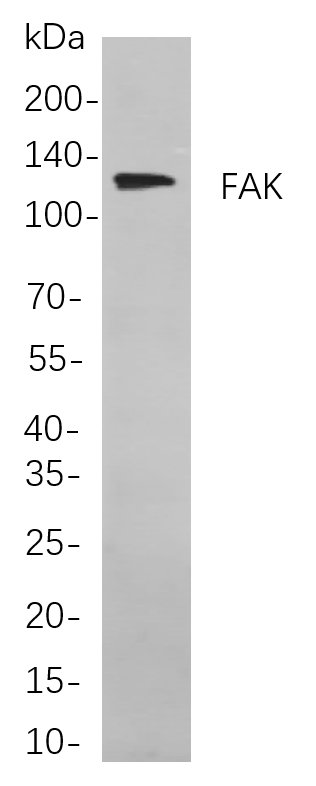 Recombinant FAK Monoclonal Antibody-searchlist-1