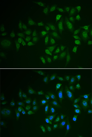 Immunofluorescence analysis of U2OS cells using MYLK3 Polyclonal Antibody