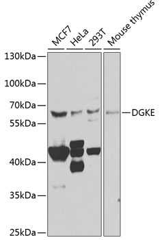 Western blot analysis of extracts of various cell lines using DGKE Polyclonal Antibody at 1:1000 dilution.